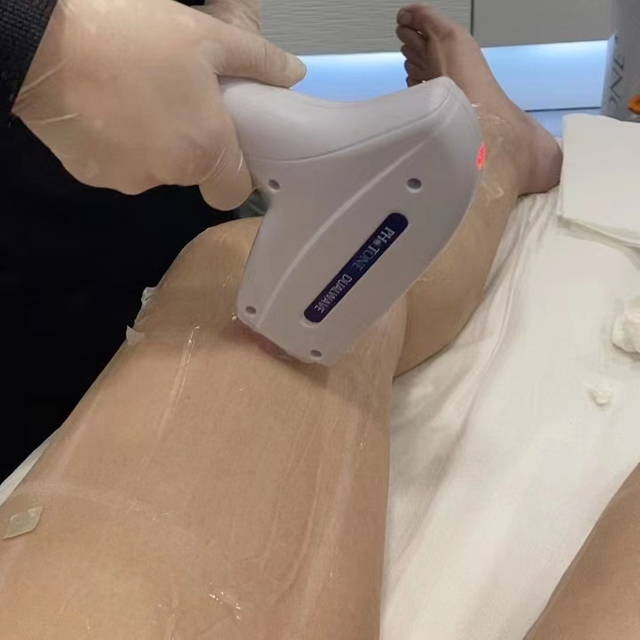 ダイオードレーザー治療装置